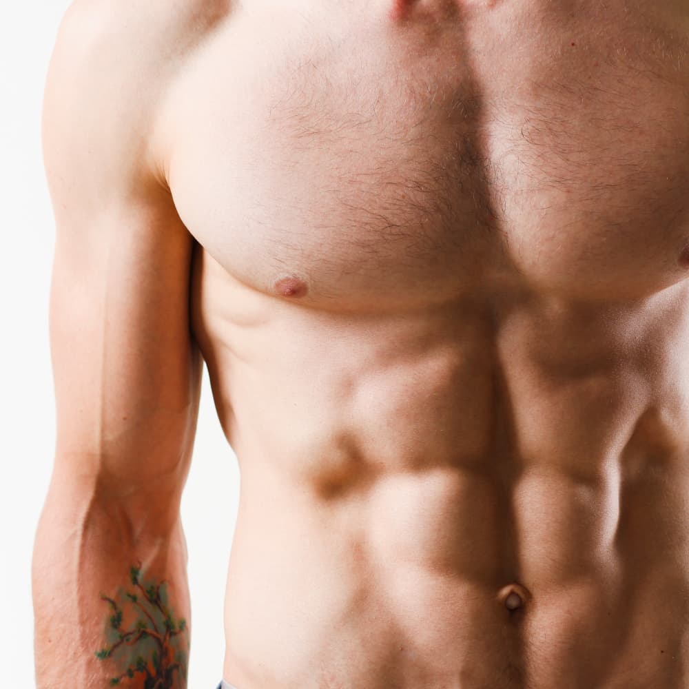 Ginecomastia Láser - Clínica del Varón